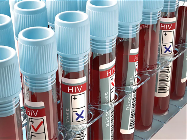 Làm thế nào để yêu an toàn khi đến năm 2021 vaccine chống HIV mới được sản xuất?