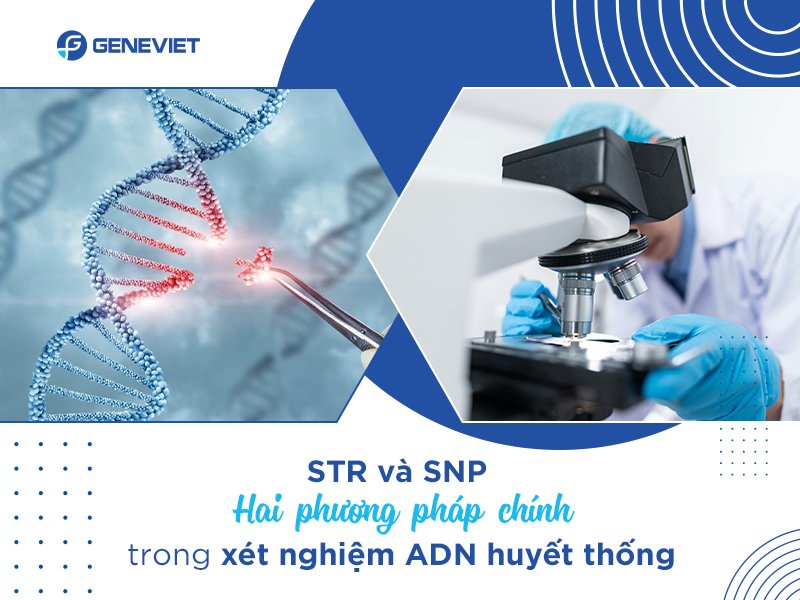 Xét nghiệm ADN xác định huyết thống 