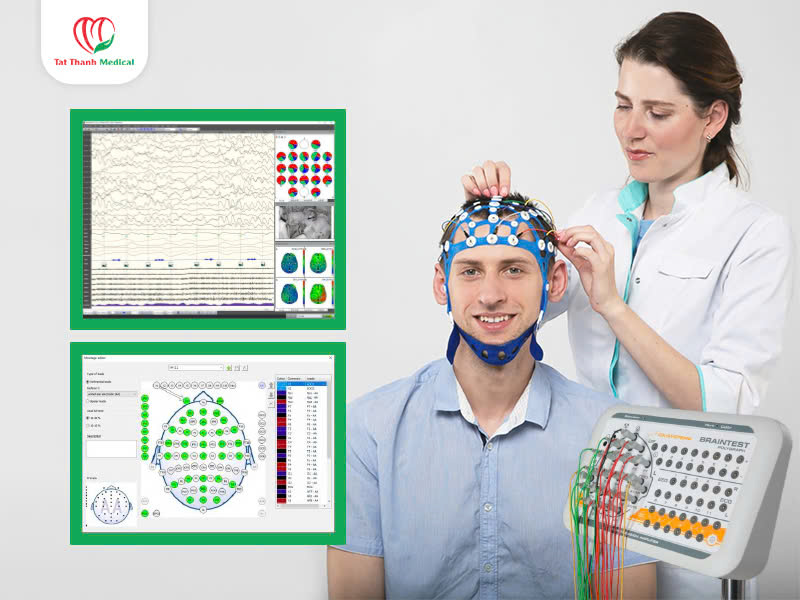 Máy điện não - Công cụ chẩn đoán thần kinh không thể thiếu