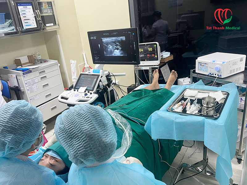 Máy đốt sóng cao tần u tuyến giáp