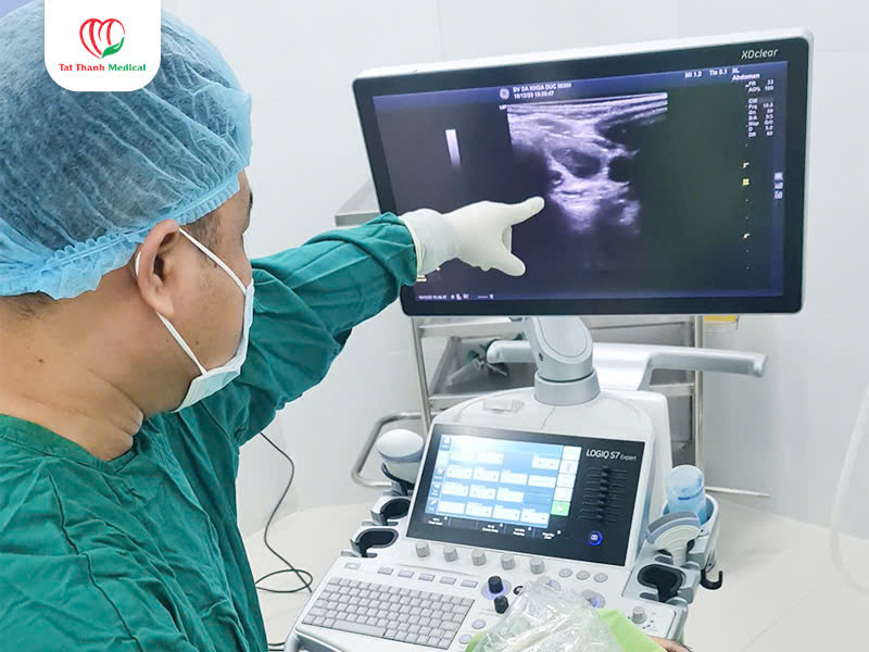 Điều trị u tuyến giáp bằng sóng cao tần RFA: Hiệu quả, an toàn, không phẫu thuật