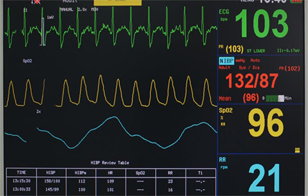 monitor theo dõi bệnh nhân 