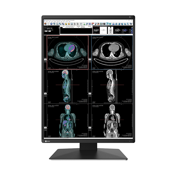 màn hình y tế eizo 