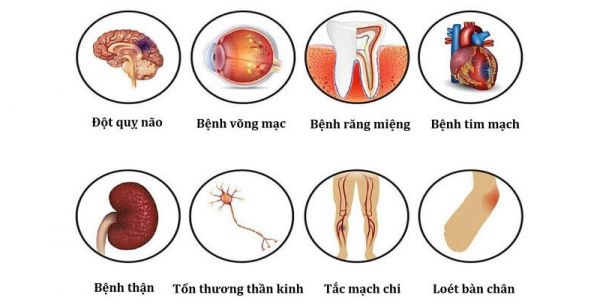 Vì sao bệnh tiểu đường được coi là “kẻ giết người thầm lặng”?