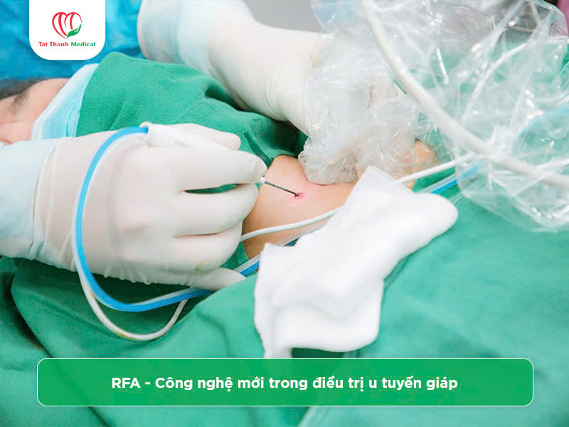 Tất Thành Medical: Tiên phong ứng dụng công nghệ RFA trong điều trị u tuyến giáp tại Việt Nam