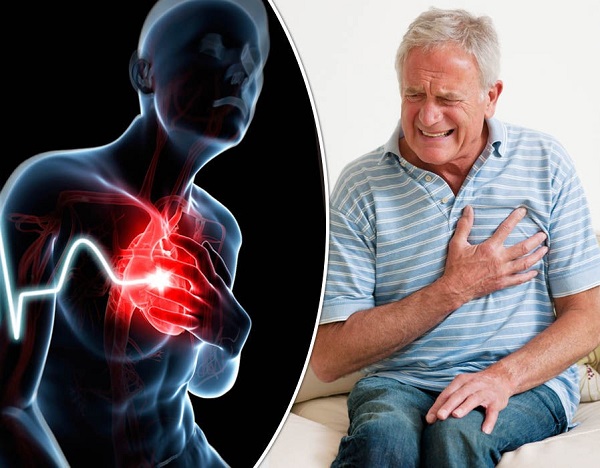 Đông trùng hạ thảo giúp phòng ngừa bệnh xơ vữa động mạch
